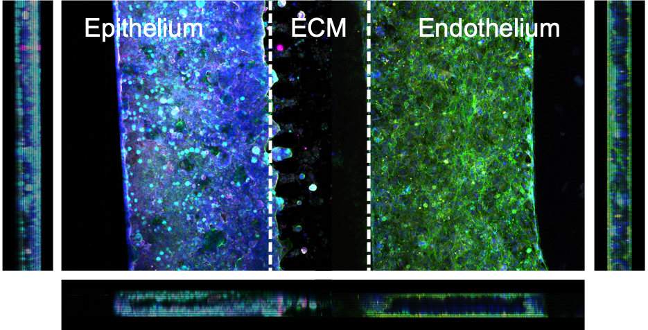 Immunofluorescence image of the gut-on-chip after one week of culture. Both intestinal epithelial cells and vascular endothelial cells show a three-dimensional tubule-like structure in the microfluidic channels